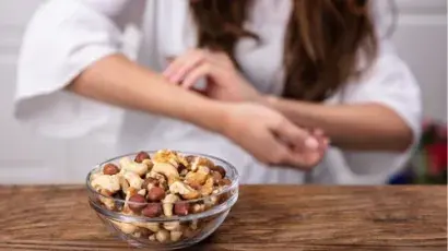 Descubre los tipos de alergias alimentarias y cómo diagnosticarlas – Adeslas Salud y Bienestar