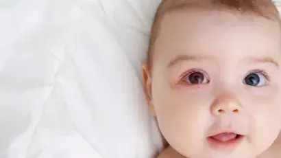 Descubre qué es y cómo prevenir la conjuntivitis en la infancia – Adeslas Salud y Bienestar