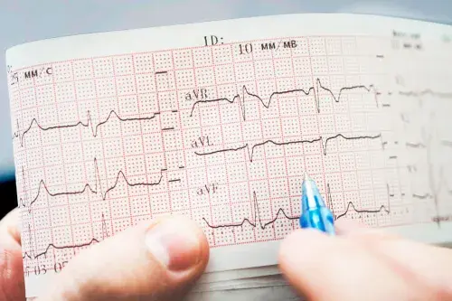 Arritmia cardiaca: ¿en qué consiste?