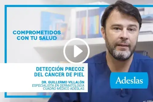 Detección precoz del cáncer de piel | Videopost del Dr. Guillermo Villalón