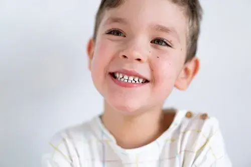 Pot ser que el meu fill no perdi mai les dents de llet?